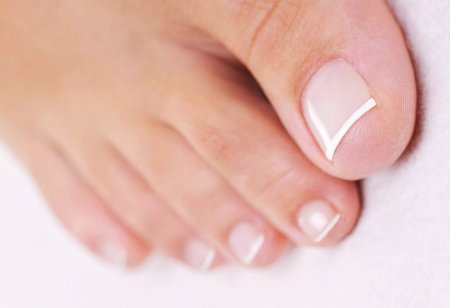 Лечение вросшего ногтя на ноге в алматы thumbnail